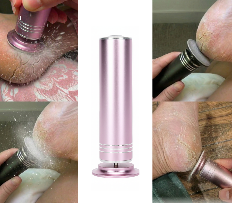 Removedor de callos y grietas