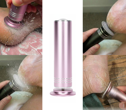 Removedor de callos y grietas